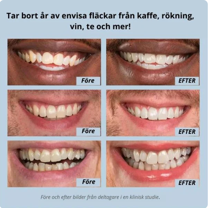 Narella® Snabb Tandblekning