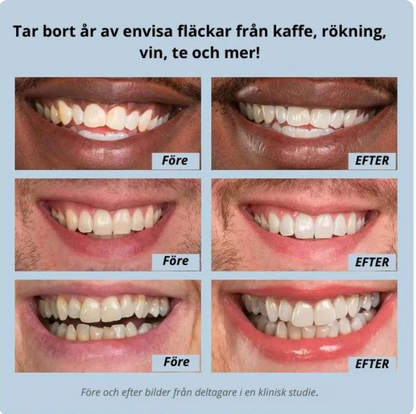 Narella® Snabb Tandblekning
